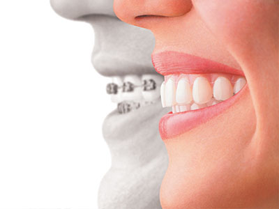 Sonrisa Family Dental | Teeth Whitening, Fluoride Treatment and Orthodontics