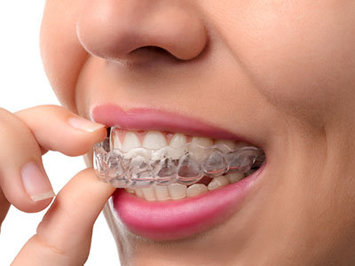 Sonrisa Family Dental | Laser Dentistry, Preventative Program and Implant Dentistry