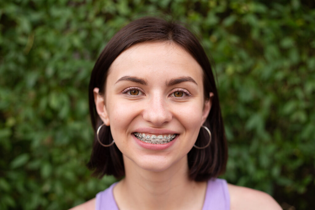 Young girl with bob hairstyle and puкple t-shirt smiling with metal dental braces for bite correction on teeth